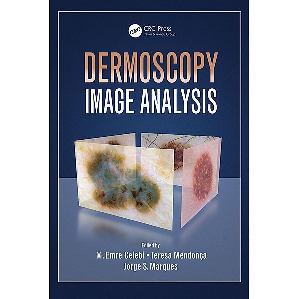 Dermoscopy Image Analysis