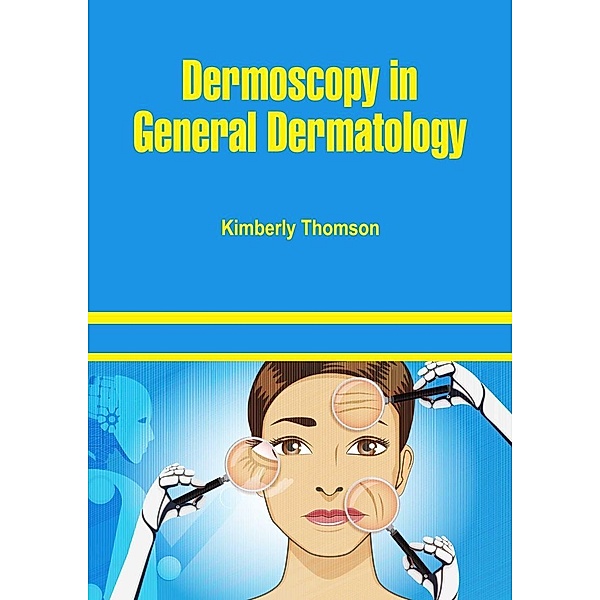 Dermoscopy in General Dermatology, Kimberly Thomson