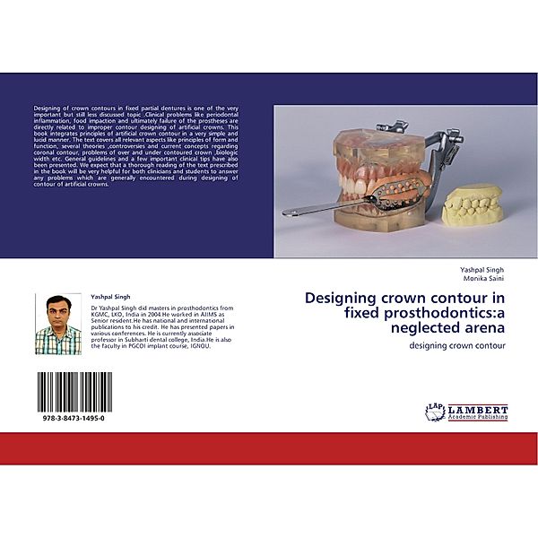 Designing crown contour in fixed prosthodontics:a neglected arena, Yashpal Singh, Monika Saini