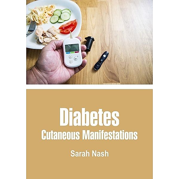 Diabetes, Sarah Nash