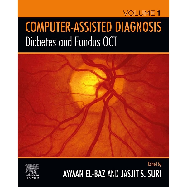 Diabetes and Fundus OCT