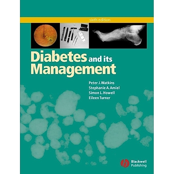 Diabetes and Its Management, Peter J. Watkins, Stephanie A. Amiel, Simon L. Howell, Eileen Turner