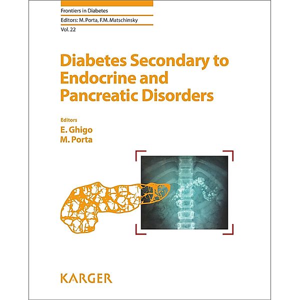 Diabetes Secondary to Endocrine and Pancreatic Disorders