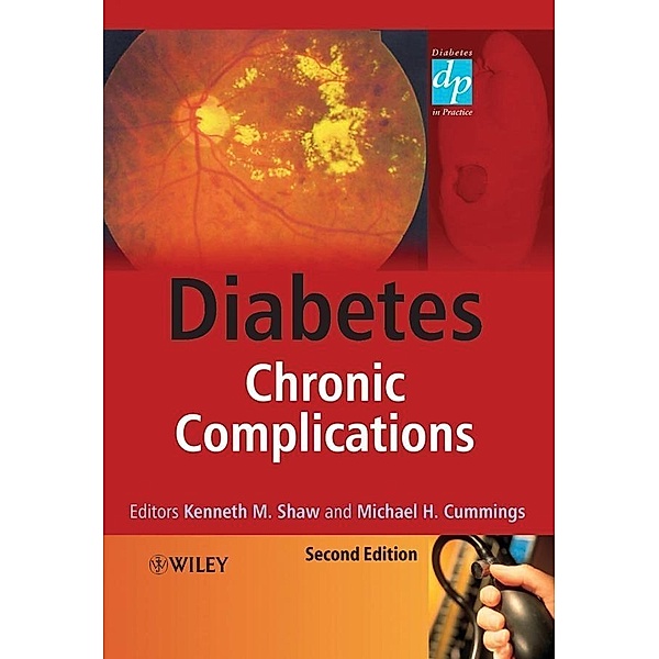 Diabetes / Wiley Diabetes in Practice Series