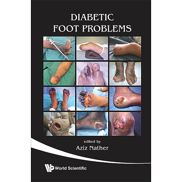 Diabetic Foot Problems