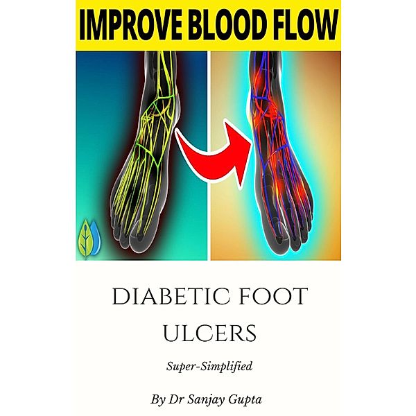 Diabetic Foot Ulcers Super-Simplified, Sanjay Gupta