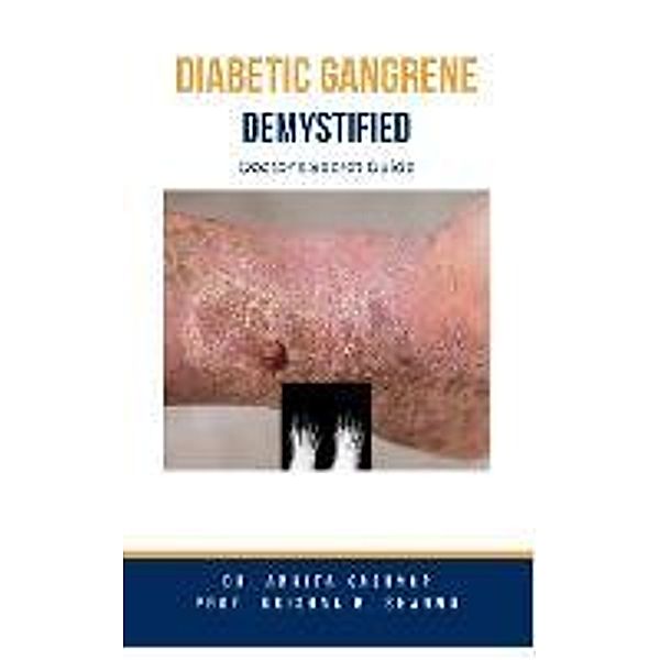 Diabetic Gangrene Demystified: Doctor's Secret Guide, Ankita Kashyap, Krishna N. Sharma