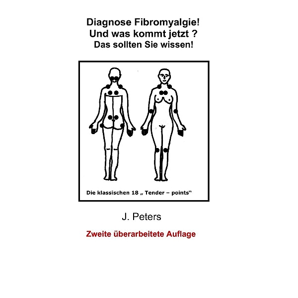 Diagnose Fibromyalgie! Und was kommt jetzt?, Joachim Peters