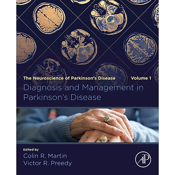 Diagnosis and Management in Parkinson's Disease