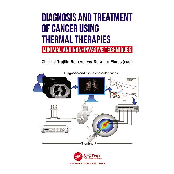 Diagnosis and Treatment of Cancer using Thermal Therapies