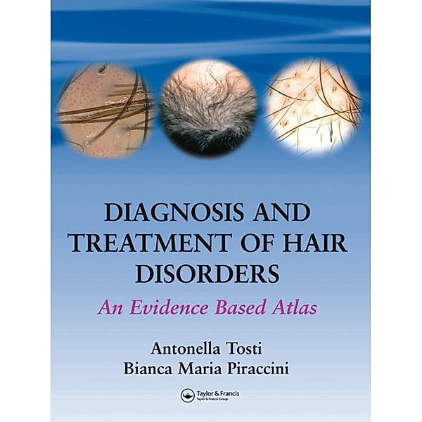 Diagnosis and Treatment of Hair Disorders, Antonella Tosti, Bianca Maria Piraccini