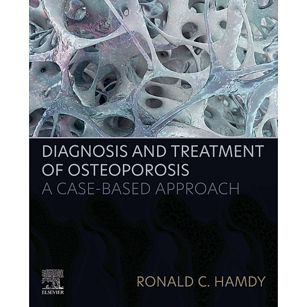 Diagnosis and Treatment of Osteoporosis, Ronald C. Hamdy
