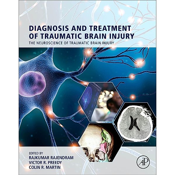 Diagnosis and Treatment of Traumatic Brain Injury