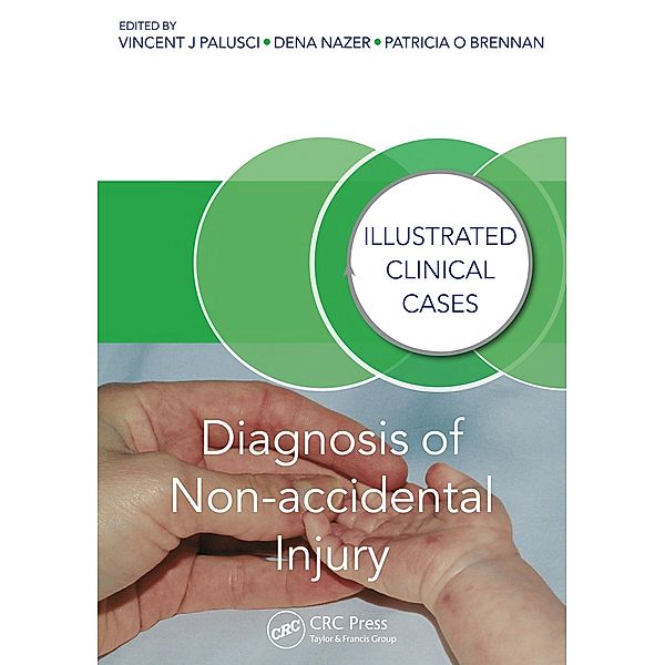 Diagnosis of Non-accidental Injury