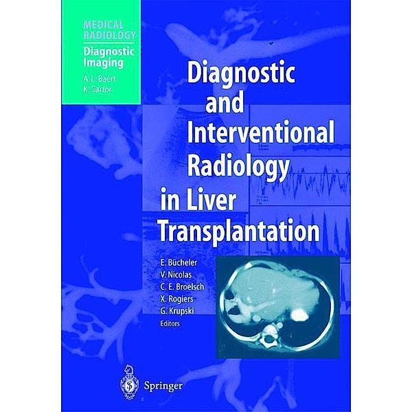 Diagnostic and Interventional Radiology in Liver Transplantation, C. E. Broelsch, X. Rogiers, G. Krupski