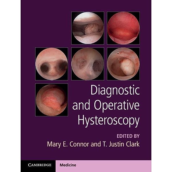 Diagnostic and Operative Hysteroscopy