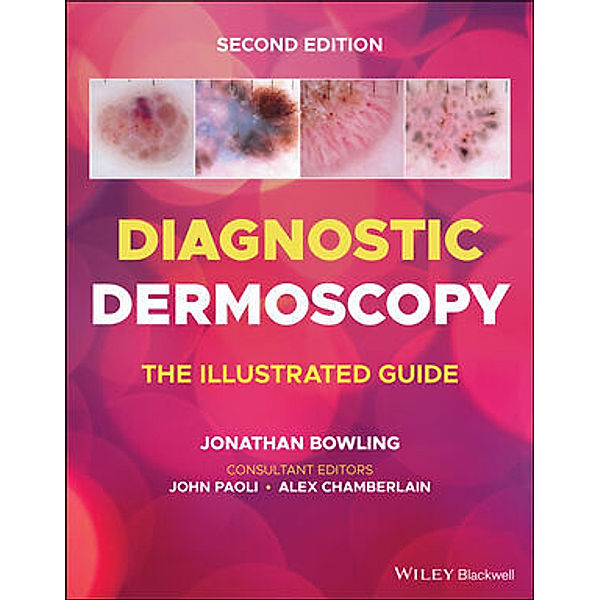 Diagnostic Dermoscopy, Diagnostic Dermoscopy