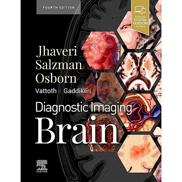 Diagnostic Imaging: Brain, Miral D. Jhaveri