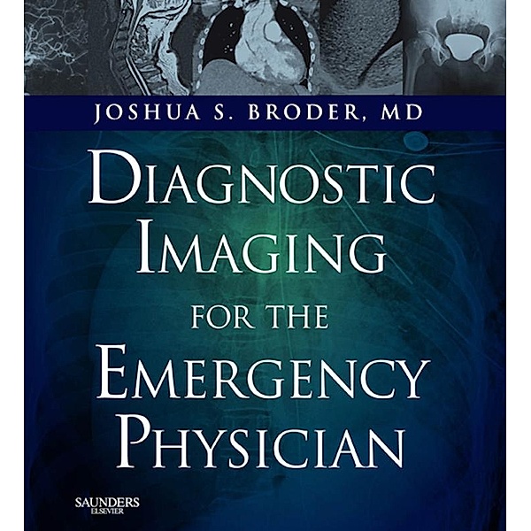 Diagnostic Imaging for the Emergency Physician E-Book, Joshua S. Broder