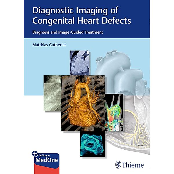 Diagnostic Imaging of Congenital Heart Defects