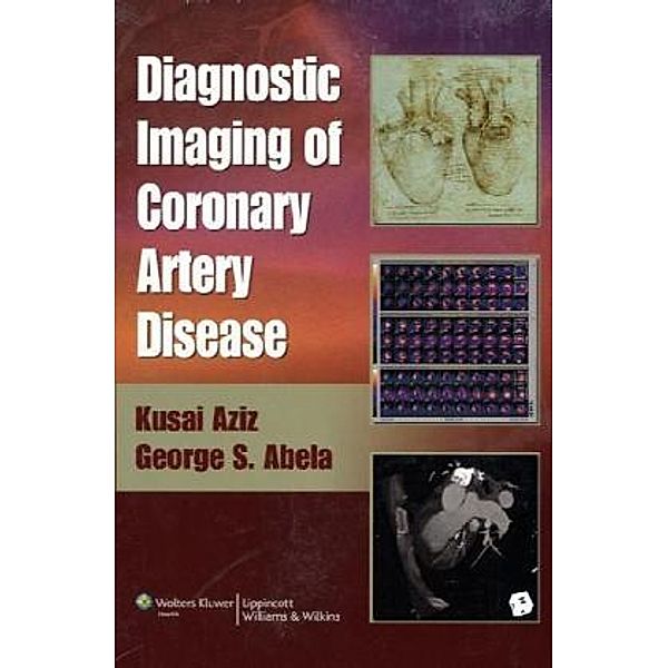 Diagnostic Imaging of Coronary Artery Disease, George S. Abela