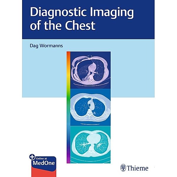Diagnostic Imaging of the Chest