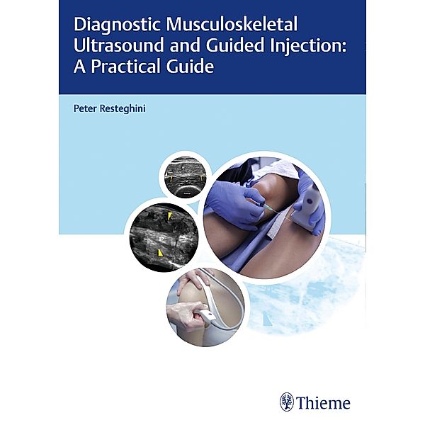 Diagnostic Musculoskeletal Ultrasound and Guided Injection: A Practical Guide, Peter Resteghini