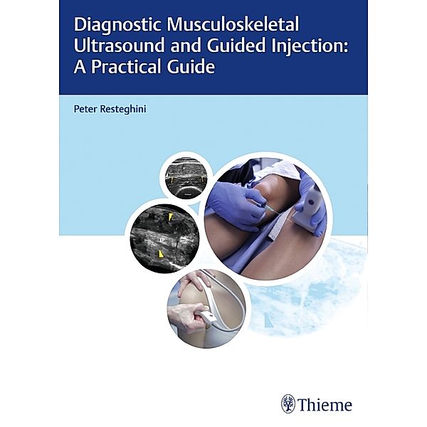 Diagnostic Musculoskeletal Ultrasound and Guided Injection: A Practical Guide; ., Peter Resteghini