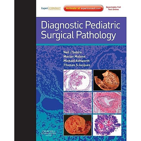 Diagnostic Pediatric Surgical Pathology E-Book, Neil Sebire, Marian Malone, Michael Ashworth, Thomas S. Jacques