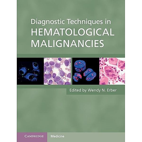 Diagnostic Techniques in Hematological Malignancies