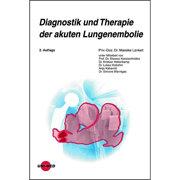 Diagnostik und Therapie der akuten Lungenembolie / UNI-MED Science, Mareike Lankeit