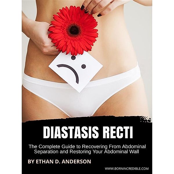 Diastasis Recti, Ethan D. Anderson