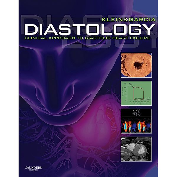 Diastology E-Book, Allan L. Klein, Mario J. Garcia