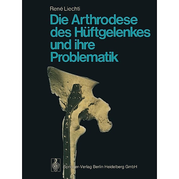 Die Arthrodese des Hüftgelenkes und ihre Problematik, R. Liechti