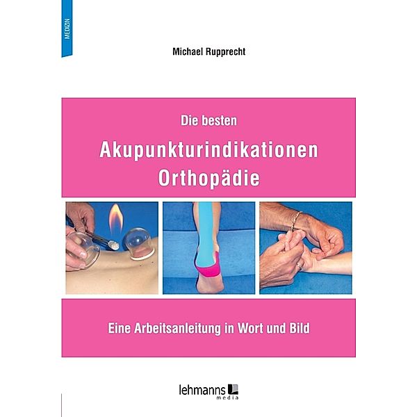 Die besten Akupunkturindikationen Orthopädie, Michael Rupprecht