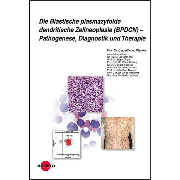 Die Blastische plasmazytoide dendritische Zellneoplasie (BPDCN) - Pathogenese, Diagnostik und Therapie / UNI-MED Science, Claus-Detlev Klemke