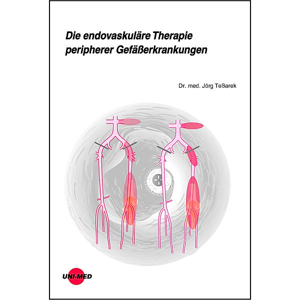 Die endovaskuläre Therapie peripherer Gefäßerkrankungen, Jörg Teßarek