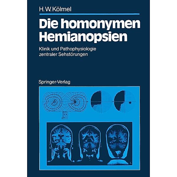 Die homonymen Hemianopsien, Hans W. Kölmel