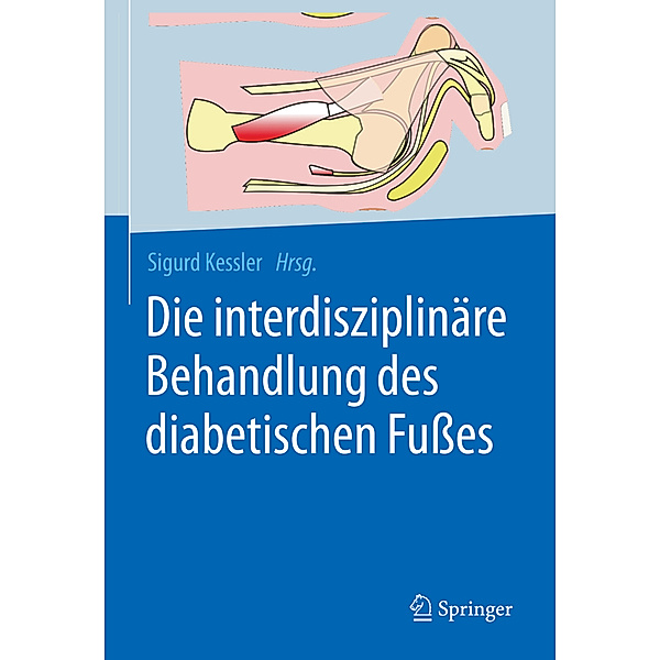 Die interdisziplinäre Behandlung des diabetischen Fußes