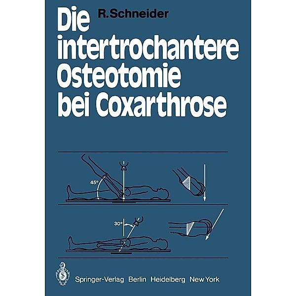 Die intertrochantere Osteotomie bei Coxarthrose, R. Schneider