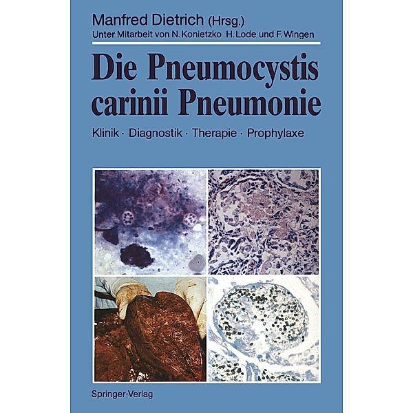 Die Pneumocystis carinii Pneumonie