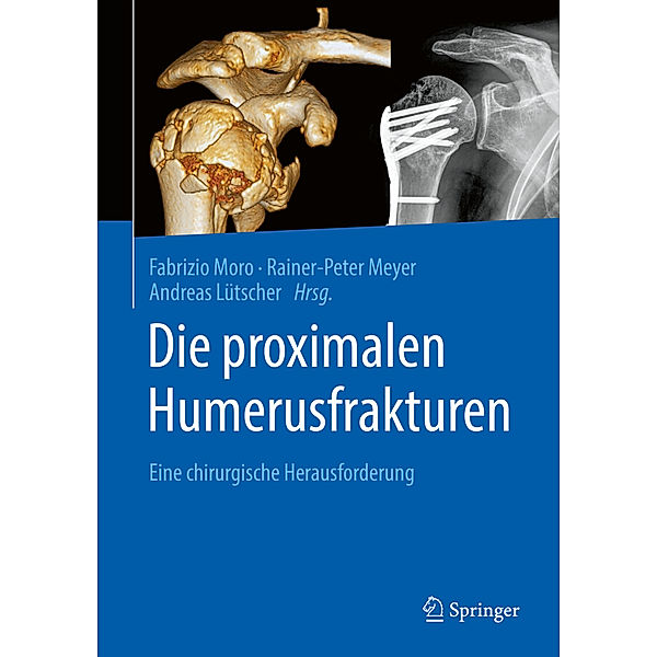 Die proximalen Humerusfrakturen