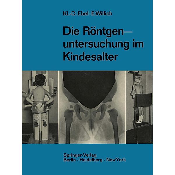 Die Röntgenuntersuchung im Kindesalter, Klaus-Dietrich Ebel, Eberhard Willich