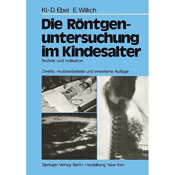 Die Röntgenuntersuchung im Kindesalter, Klaus-D. Ebel, Eberhard Willich