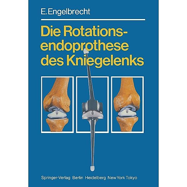 Die Rotationsendoprothese des Kniegelenks, E. Engelbrecht