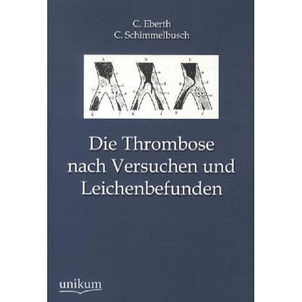 Die Thrombose nach Versuchen und Leichenbefunden, C. Eberth, C. Schimmelbusch