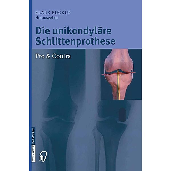 Die unikondyläre Schlittenprothese Pro & Contra