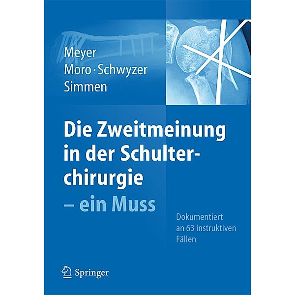 Die Zweitmeinung in der Schulterchirurgie - ein Muss, Fabrizio Moro, Hans-Kaspar Schwyzer, Beat R. Simmen