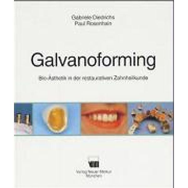 Diedrichs, G: Galvanoforming, Gabriele Diedrichs, Paul Rosenhain