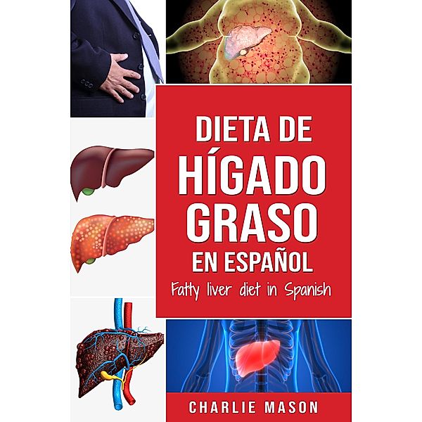 Dieta de hígado graso en español/Fatty liver diet in Spanish, Charlie Mason